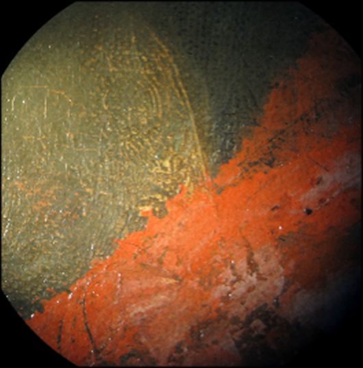 IIIF Image